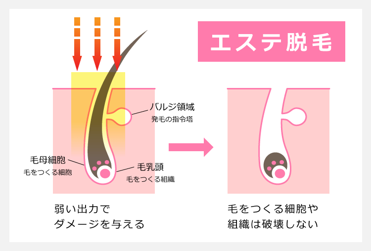 医療脱毛クリニックってどうなの 賢い女性が選ぶおすすめクリニックを比較